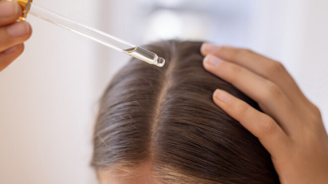 perimenopause hair loss