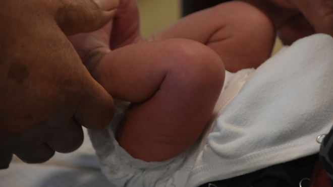 Baby Nearly Bleeds to Death After Circumcision